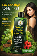 Natural Herbal Hair Oil – Zero Hair Fall Formula | 100% Herbal | Strong, Thick & Shiny Hair in 3 Weeks